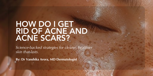 How Do I Get Rid of Acne and Acne Scars? A Dermatologist’s Complete Guide to Clearer Skin