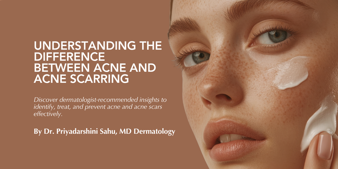Understanding the Difference Between Acne and Acne Scarring: A Dermatologist’s Perspective