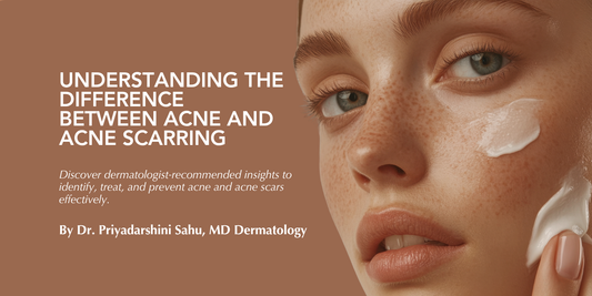 Understanding the Difference Between Acne and Acne Scarring: A Dermatologist’s Perspective