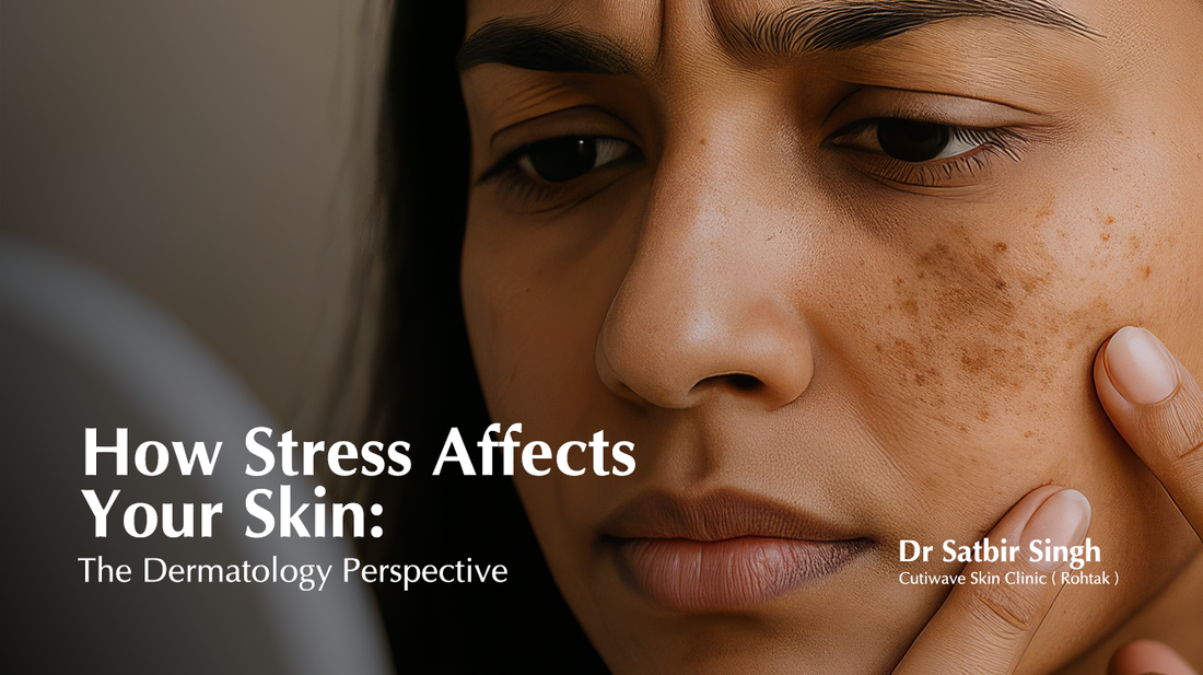 How Stress Affects Your Skin: The Dermatology Perspective