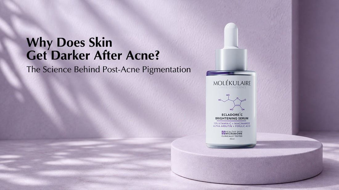 Why Does Skin Get Darker After Acne? The Science Behind Post-Acne Dark Spots