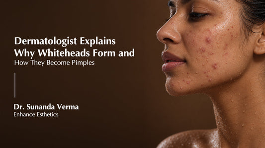 Dermatologist Explains Why Whiteheads Form and How They Become Pimples