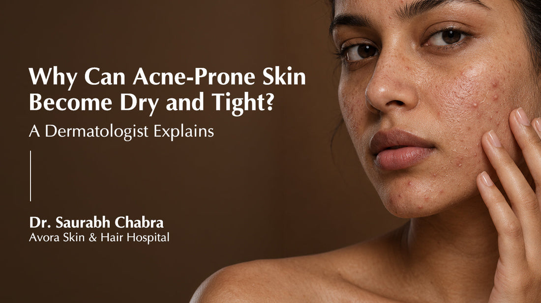 Why Can Acne-Prone Skin Become Dry and Tight? A Dermatologist Explains