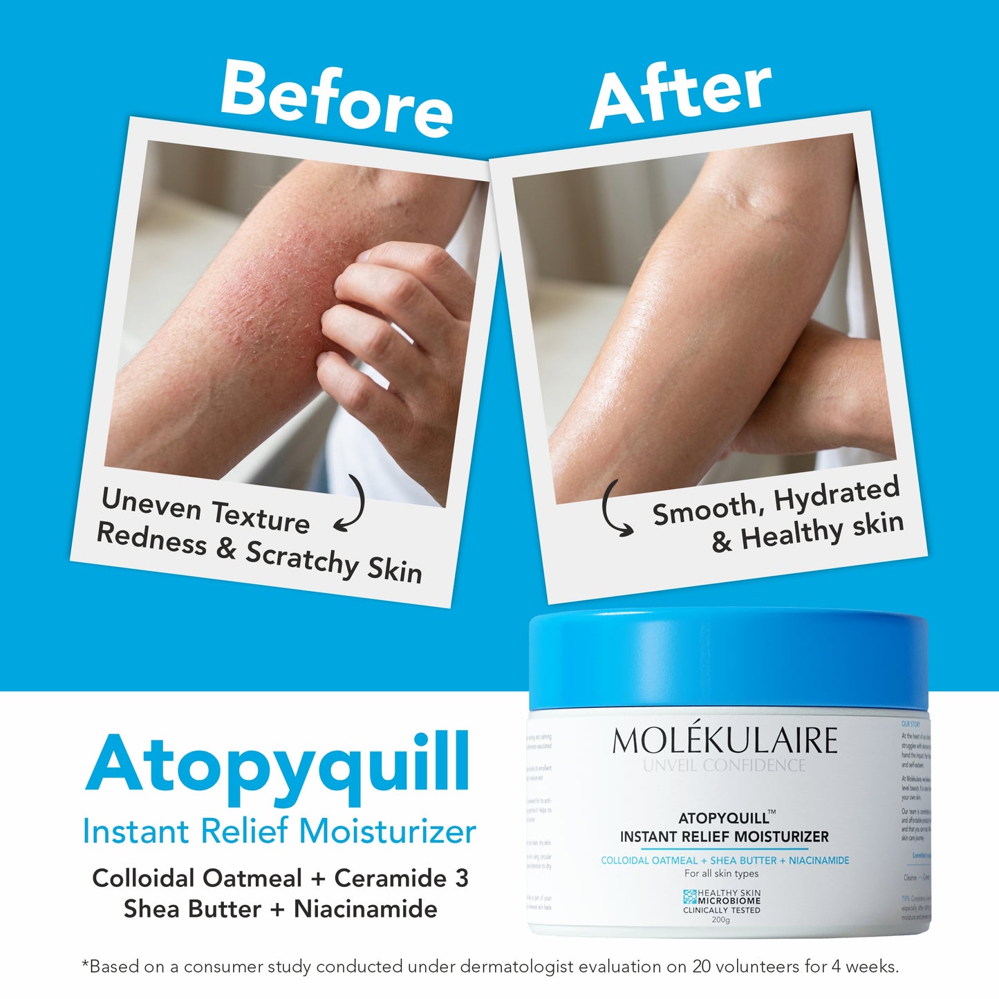 Atopyquill Colloidal Oatmeal Instant Relief Moisturizer 200g