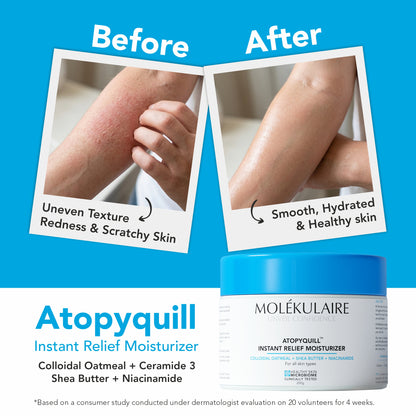 Atopyquill Colloidal Oatmeal Instant Relief Moisturizer 200g